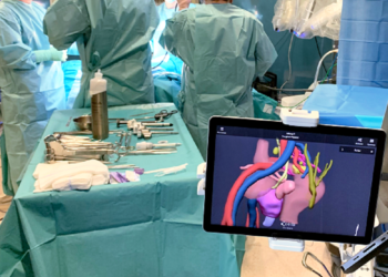 La Tecnología 3D Mejora Los Resultados De La Cirugía En La Enfermedad De Crohn, Según Un Estudio