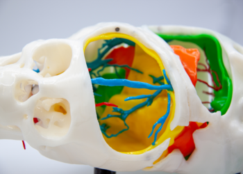 Tecnología 3D Española De Cella Ayuda A Separar Con éxito A Dos Gemelas Egipcias