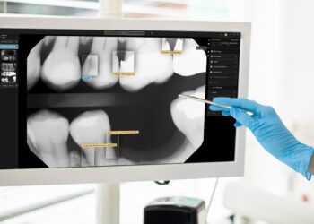 Avodent Confía En La IA De Second Opinion Para Mejorar La Experiencia De Sus Pacientes