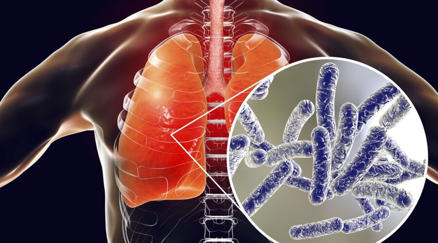 Rentokil Initial: Nuevas Medidas Para Proteger La Salud Pública: Así Es El Nuevo Real Decreto Para La Prevención Y El Control De La Legionelosis