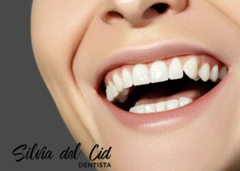 Clínica Dental Silvia Del Cid En Torremolinos: Innovando En Odontología Estética
